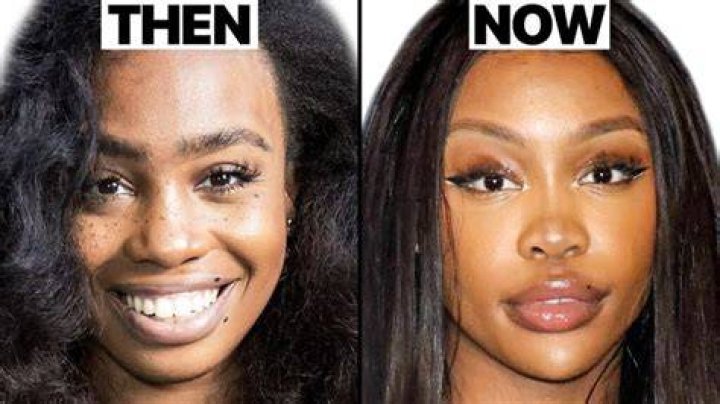 Groundbreaking Discoveries And Insights In SZA Surgery
