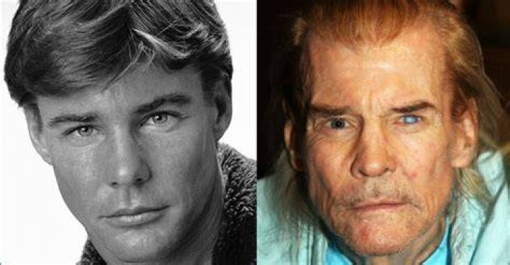 Jan Michael Vincent's Triumph Over Amputation