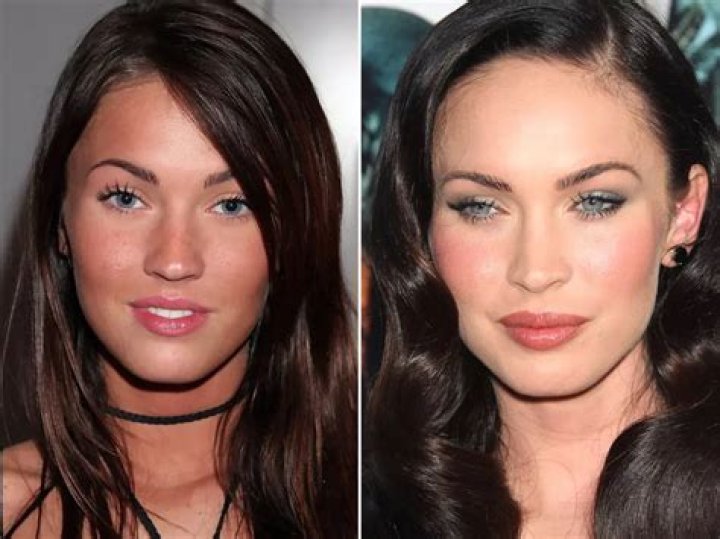 Megan Fox Before and After Plastic Surgery A Tale of Evolution ASEAN TV