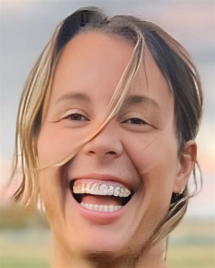 Model Kate Stoltz&rsquo;s Bio Net Worth, Boyfriend, Dating Plastic Surgeon
